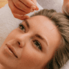 Acupuntura facial | Treatwell