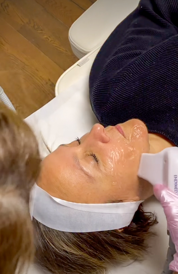 Radiofrecuencia facial, IG @sadaf_jaffari | Treatwell