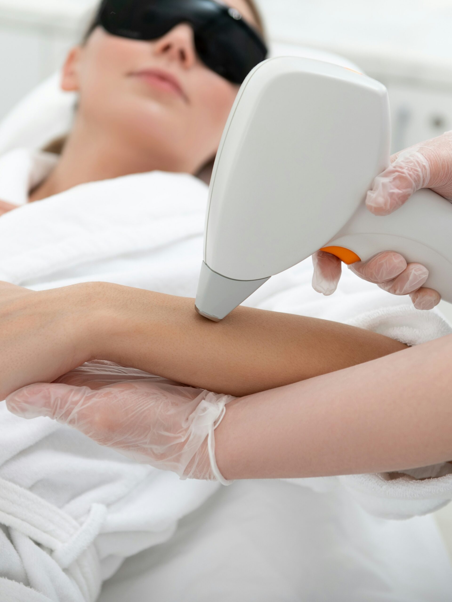 Mujer recibiendo un tratamiento de IPL en el brazo en una clínica
