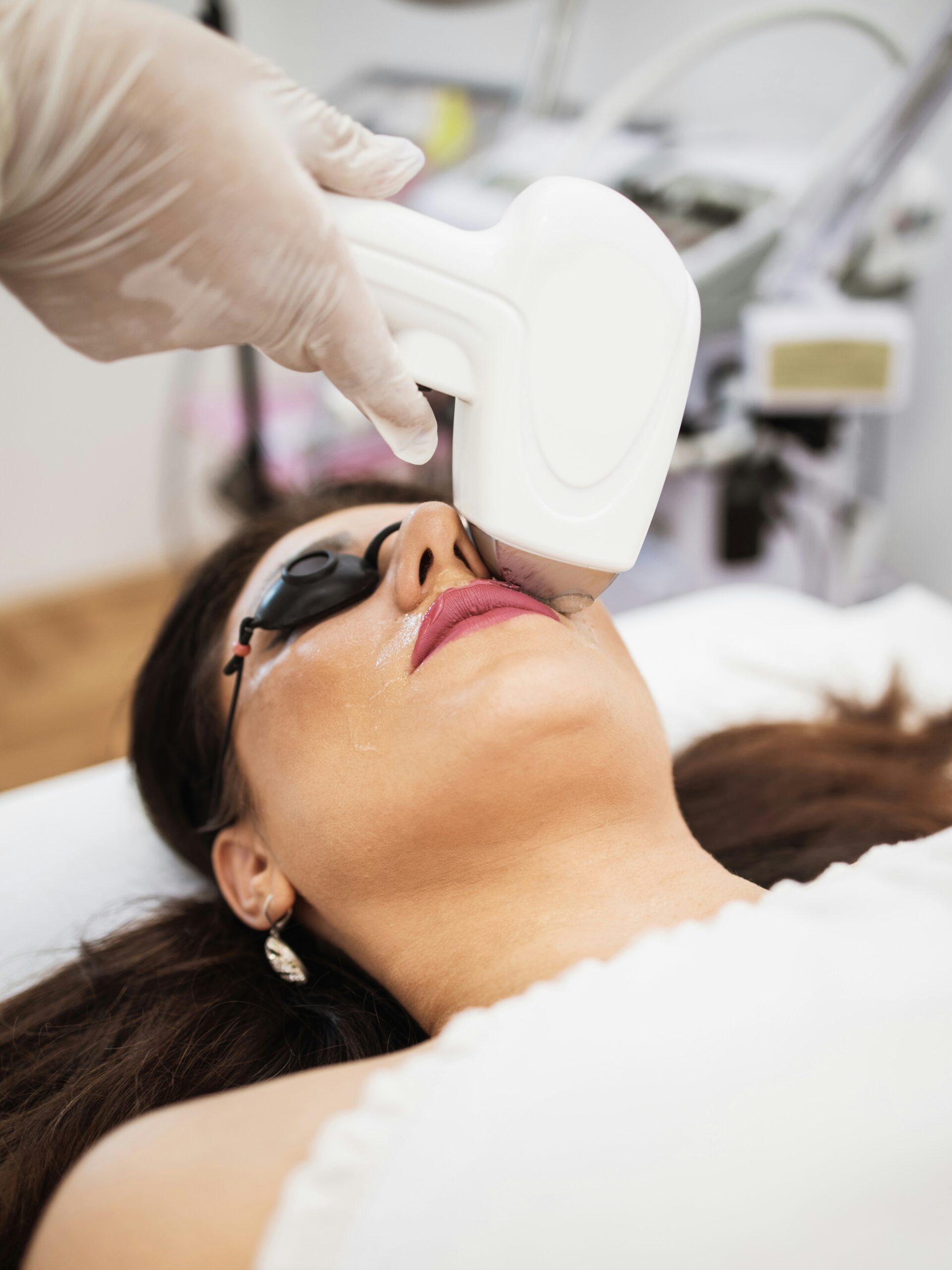 Mujer recibiendo un tratamiento de IPL en el labio superior en una clínica