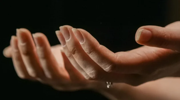 Dos manos extendidas con las palmas hacia arriba y uñas que se descaman