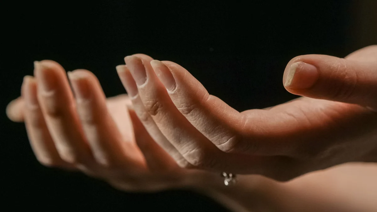 Dos manos extendidas con las palmas hacia arriba y uñas que se descaman